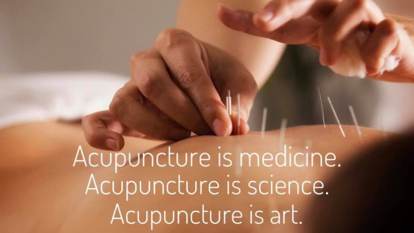Jenny Vargas Acupuncture Natural Point Acupuncture treatments
