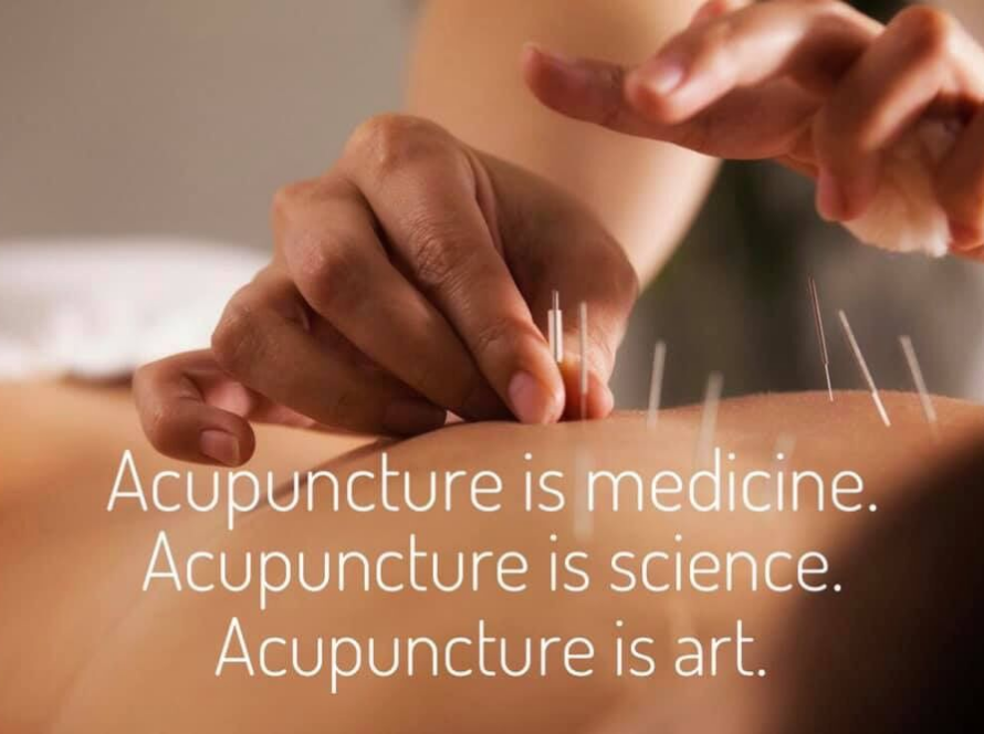 Jenny Vargas Acupuncture Natural Point Acupuncture treatments