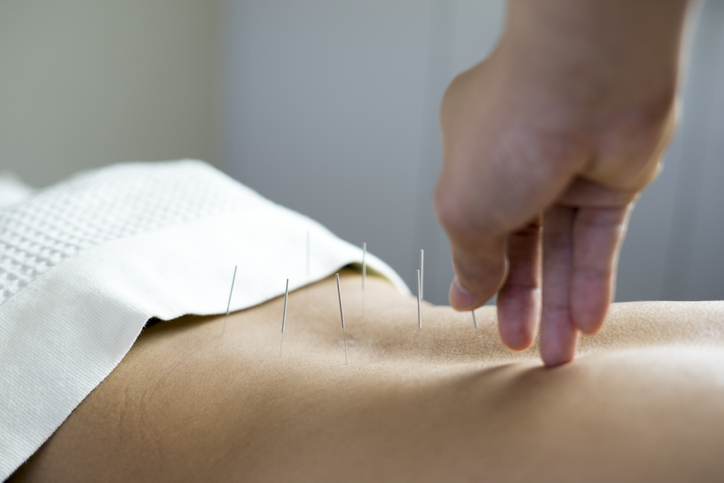 Acupuncture for low back pain.
