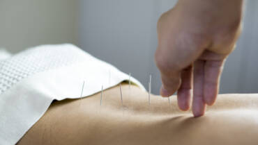 Acupuncture for Low Back Pain