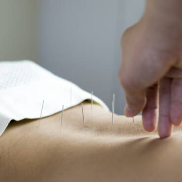 Acupuncture for Low Back Pain