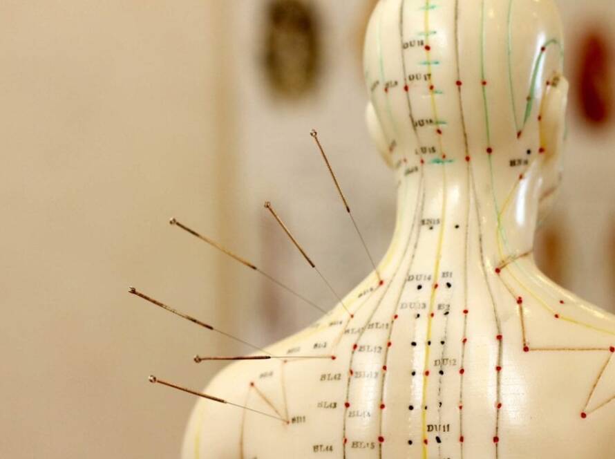 Acupuncture points from the back of the head to the shoulder blades labeled on a mannequin