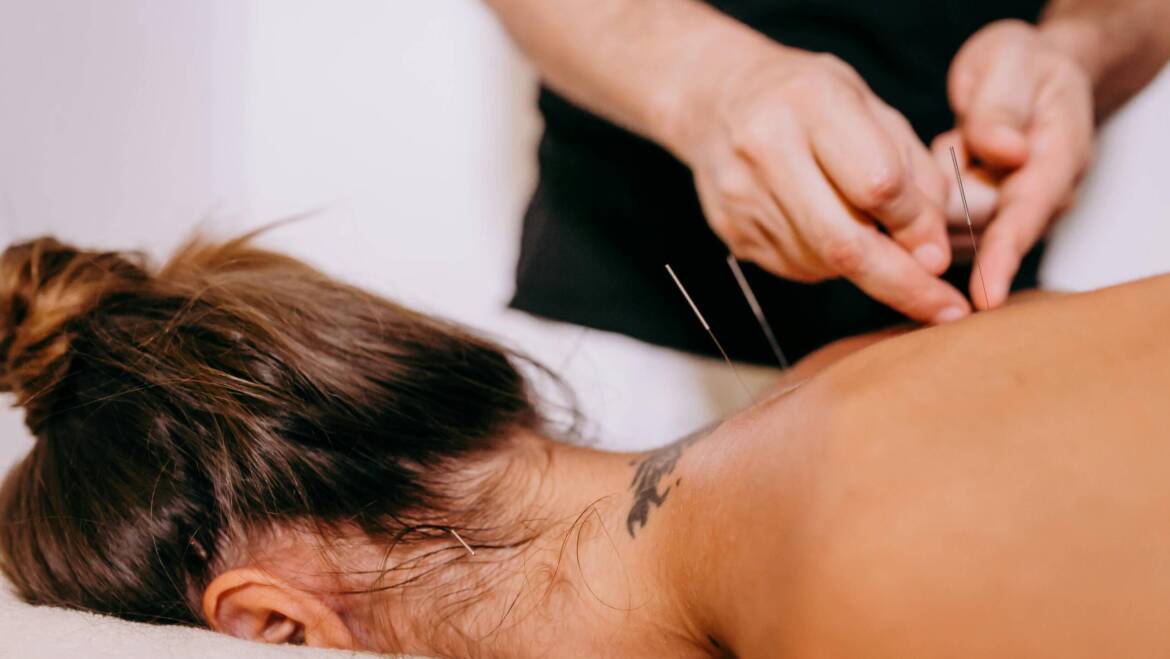 Acupuncture for Better Sleep and Relaxation During Stressful Periods