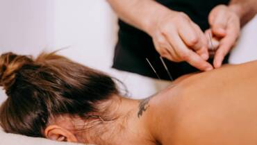 Acupuncture for Better Sleep and Relaxation During Stressful Periods