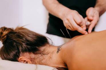 Acupuncture for Better Sleep and Relaxation During Stressful Periods