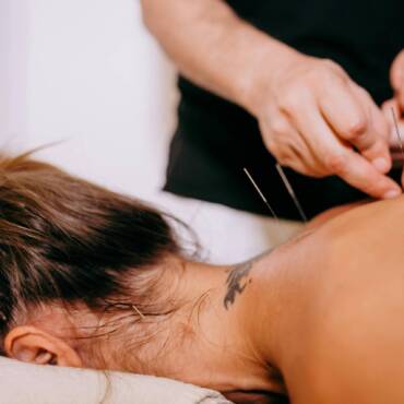 Acupuncture for Better Sleep and Relaxation During Stressful Periods