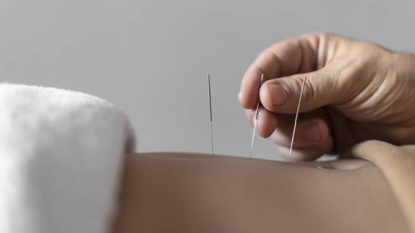Acupuncture for Menopause