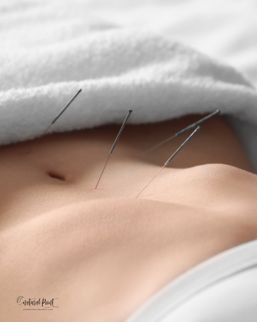 Acupuncture treatment for digestive health Houston Natural Point Acupuncture