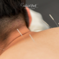 How to Treat Frozen Shoulder Effectively During Perimenopause